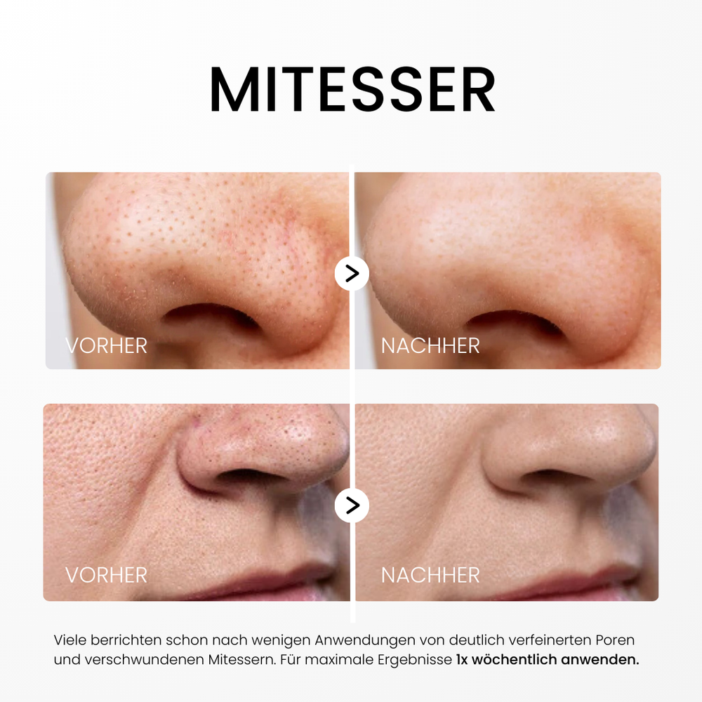 HautKlar™ - Rice Peel Glow-Serum